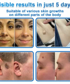 Celsiora® 2-in-1 Microneedle & Hydrocolloid Patch