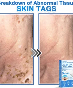 Celsiora® 2-in-1 Microneedle & Hydrocolloid Patch