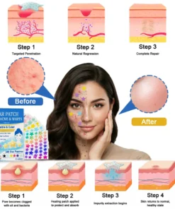 Celsiora® 2-in-1 Microneedle & Hydrocolloid Star Patch