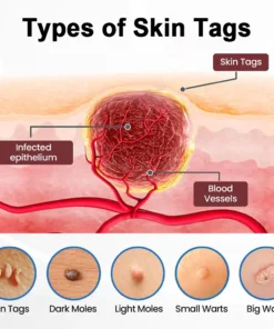 Celsiora® 2-in-1 Microneedle & Hydrocolloid Star Patch