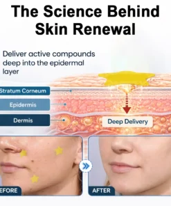 Celsiora® 2-in-1 Microneedle & Hydrocolloid Star Patch