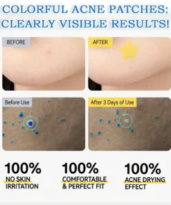 Celsiora® 2-in-1 Microneedle & Hydrocolloid Star Patch