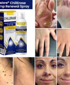 Celsiora® ChillErase Cooling Spray for Skin Tags