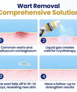 Celsiora® ChillErase Cooling Spray for Skin Tags