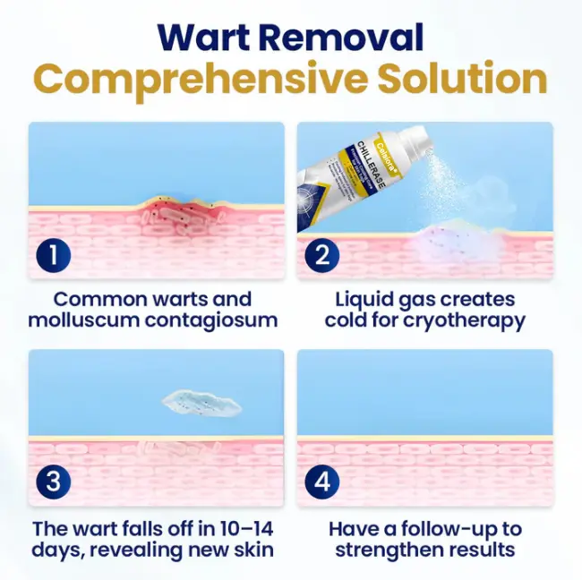 Celsiora® ChillErase Cooling Spray for Skin Tags