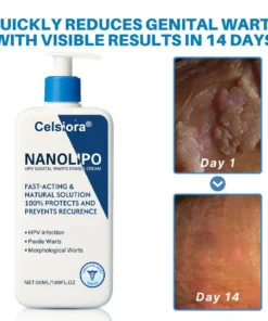 Celsiora® NanoLipo HPV Genital Warts Eraser Cream Plus+