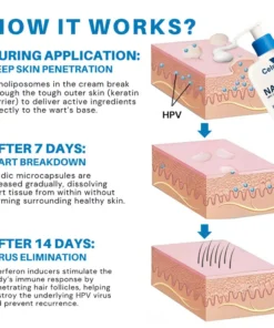 Celsiora® NanoLipo HPV Genital Warts Eraser Cream Plus+