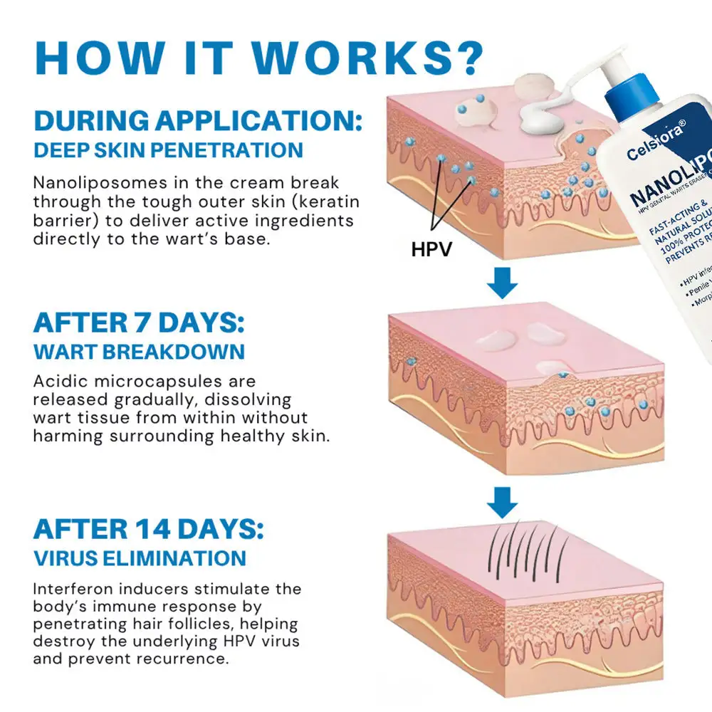 Celsiora® NanoLipo HPV Genital Warts Eraser Cream Plus+