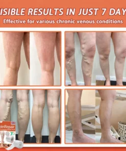 Celsiora® Vein Ease Microneedle Care Patch