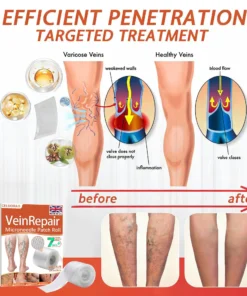 Celsiora® Vein Ease Microneedle Care Patch