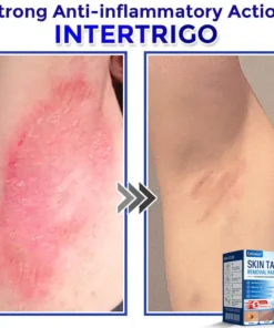 Celsiora® Multi-Functional Microneedle Hydrocolloid Patch