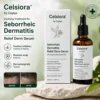 Celsiora® Seborrheic Dermatitis Relief Derm Serum
