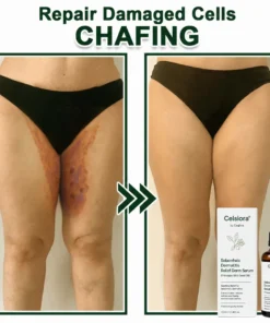 Celsiora® Seborrheic Dermatitis Relief Derm Serum