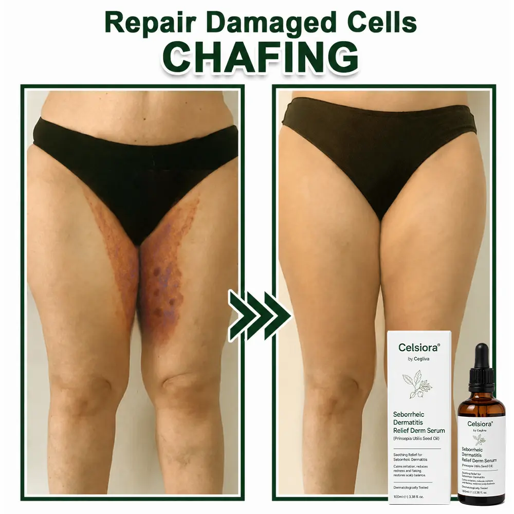 Celsiora® Seborrheic Dermatitis Relief Derm Serum