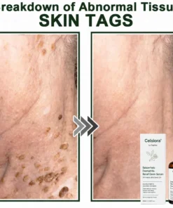 Celsiora® Seborrheic Dermatitis Relief Derm Serum