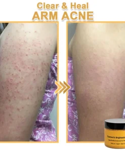 Turmeric Exfoliating Body Scrub-Celsiora®