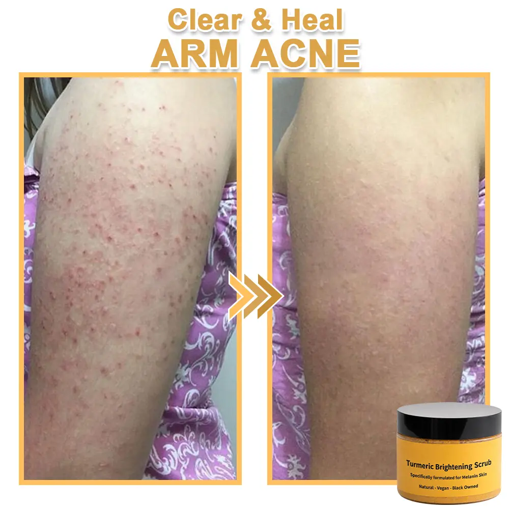 Turmeric Exfoliating Body Scrub-Celsiora®