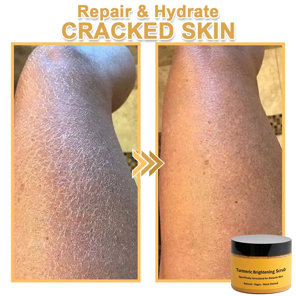 Turmeric Exfoliating Body Scrub-Celsiora®