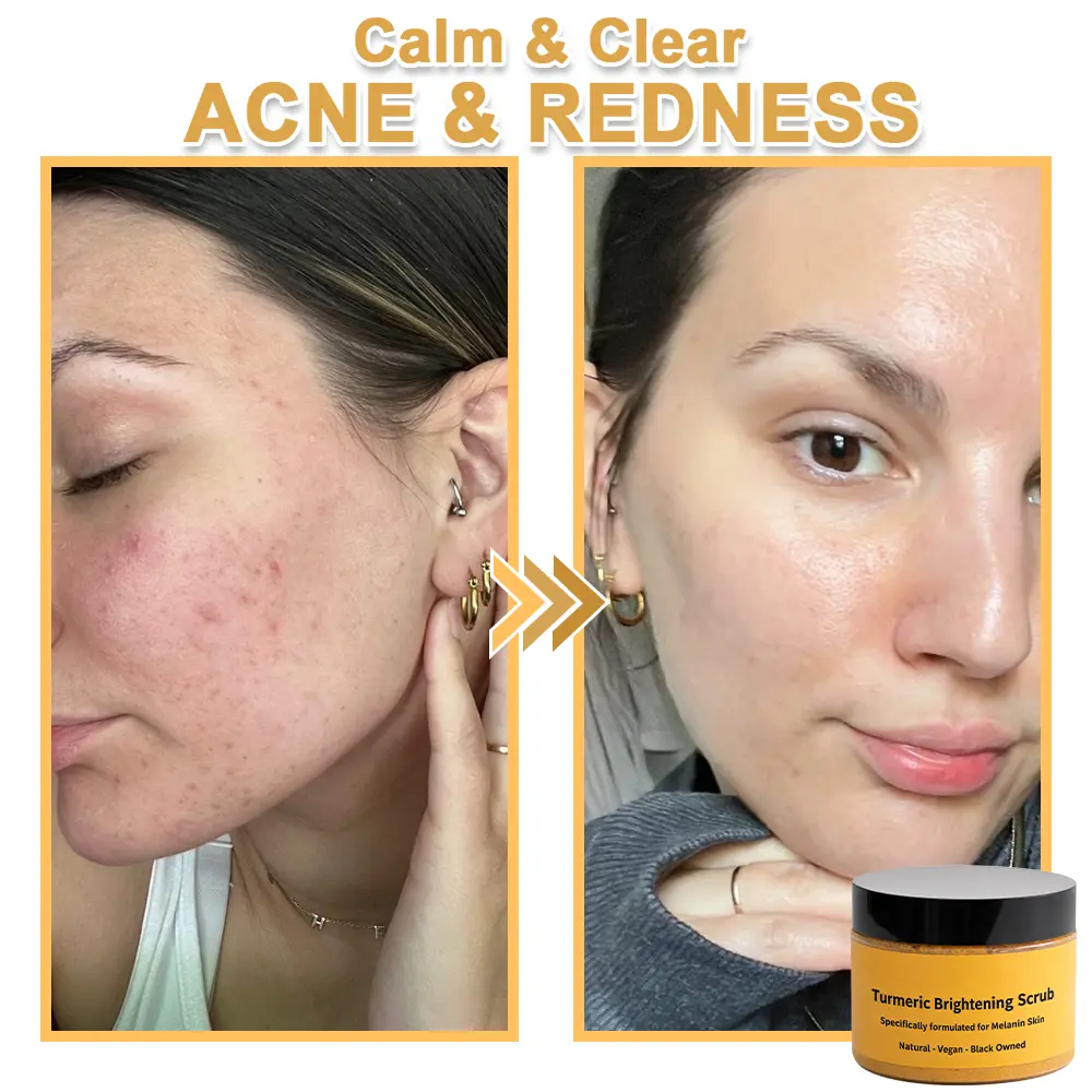 Turmeric Exfoliating Body Scrub-Celsiora®