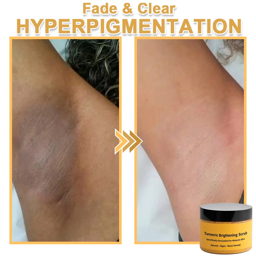 Turmeric Exfoliating Body Scrub-Celsiora®