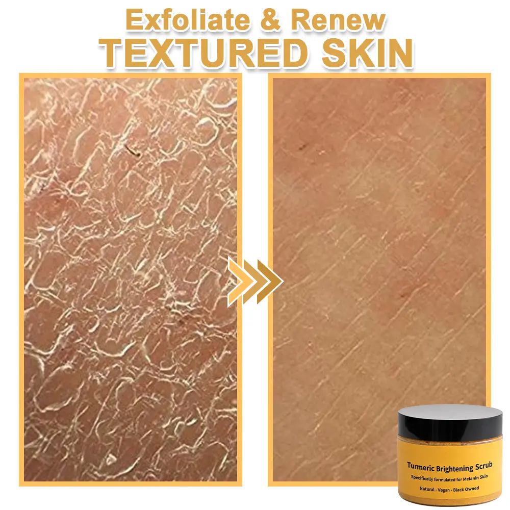 Turmeric Exfoliating Body Scrub-Celsiora®