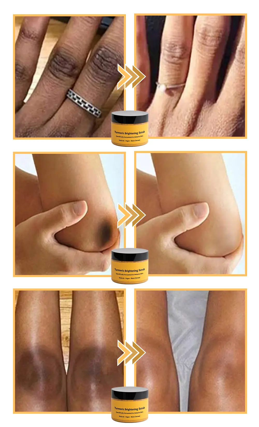 Turmeric Exfoliating Body Scrub-Celsiora®