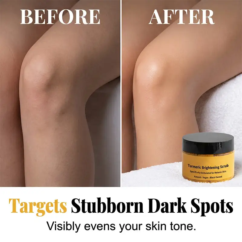 Turmeric Exfoliating Body Scrub-Celsiora®