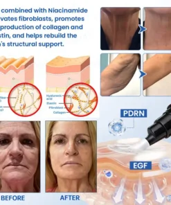 Celsiora® Botox & PDRN Anti-Wrinkle Shot Lift & Firming Cream