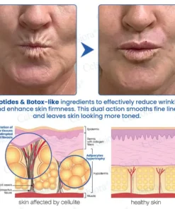 Celsiora® Botox & PDRN Anti-Wrinkle Shot Lift & Firming Cream