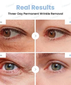 Celsiora® Botox & PDRN Anti-Wrinkle Shot Lift & Firming Cream