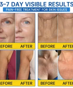 Celsiora® Botox & PDRN Anti-Wrinkle Shot Lift & Firming Cream