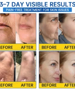 Celsiora® Botox & PDRN Anti-Wrinkle Shot Lift & Firming Cream