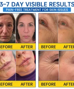 Celsiora® Botox & PDRN Anti-Wrinkle Shot Lift & Firming Cream