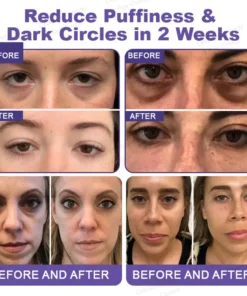 Celsiora® PDRN Renewal Complex Eye Cream