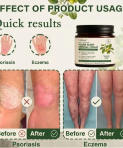 Celsiora® SkinRepair Essence Cream