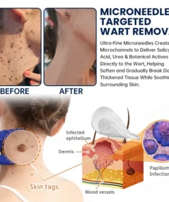 Celsiora® 7-Day MicroNeedle Skin Tag & Wart Removal Patch