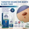 Celsiora® 7 Day Wart & Skin Tag Remover Foam