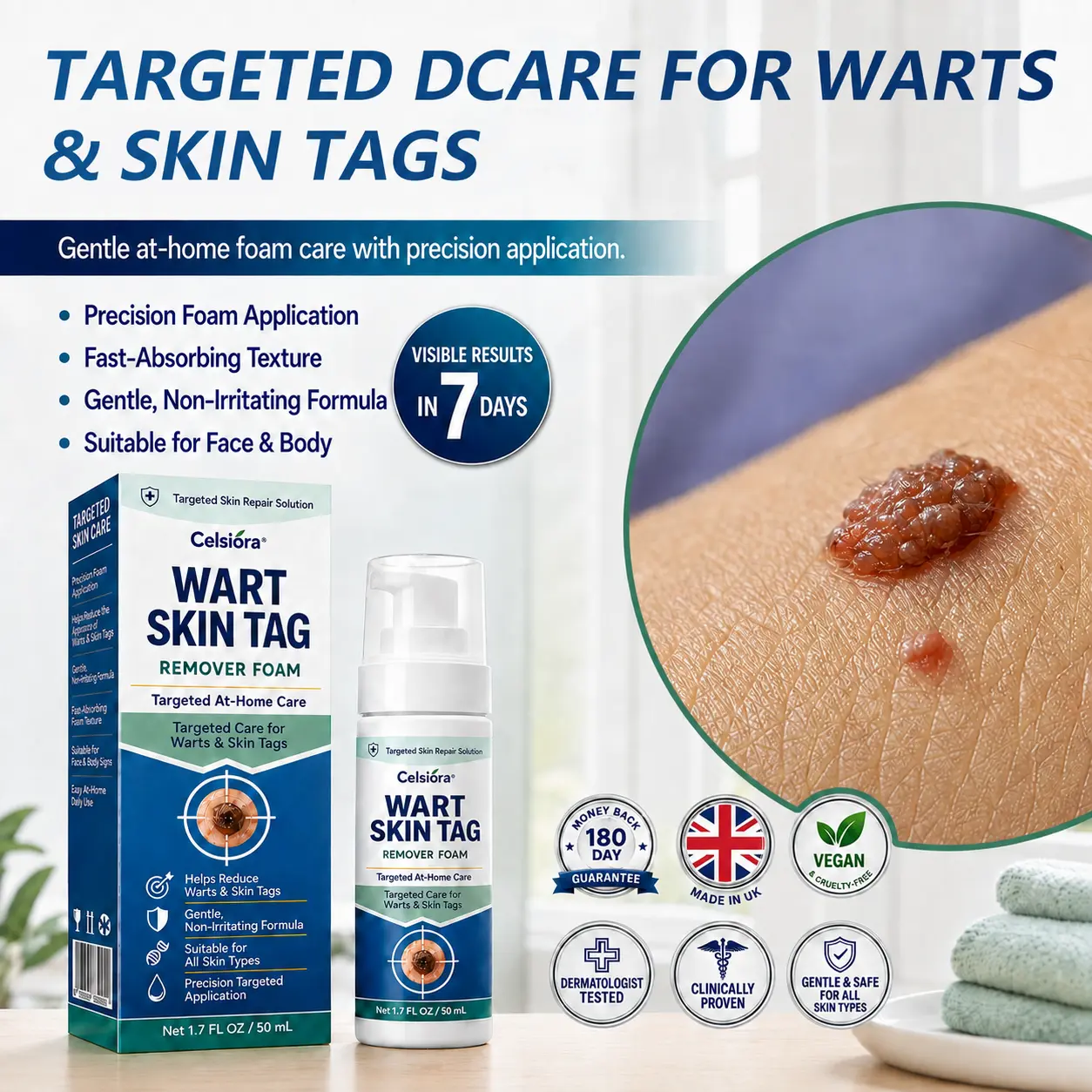 Celsiora® 7 Day Wart & Skin Tag Remover Foam