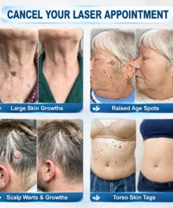 Celsiora® 7 Day Wart & Skin Tag Remover Foam