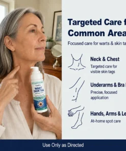 Celsiora® 7 Day Wart & Skin Tag Remover Foam
