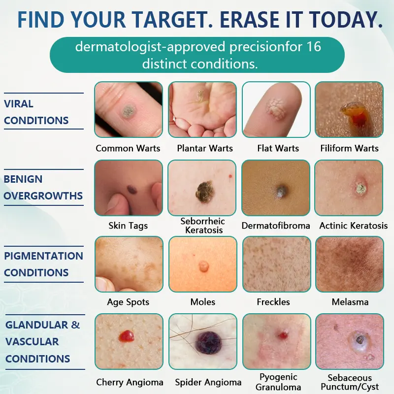 Celsiora® 7 Day Wart & Skin Tag Remover Foam