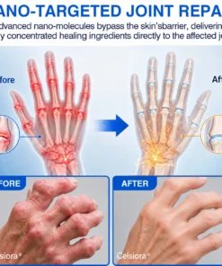Celsiora® Advanced Microneedle Joint Patch