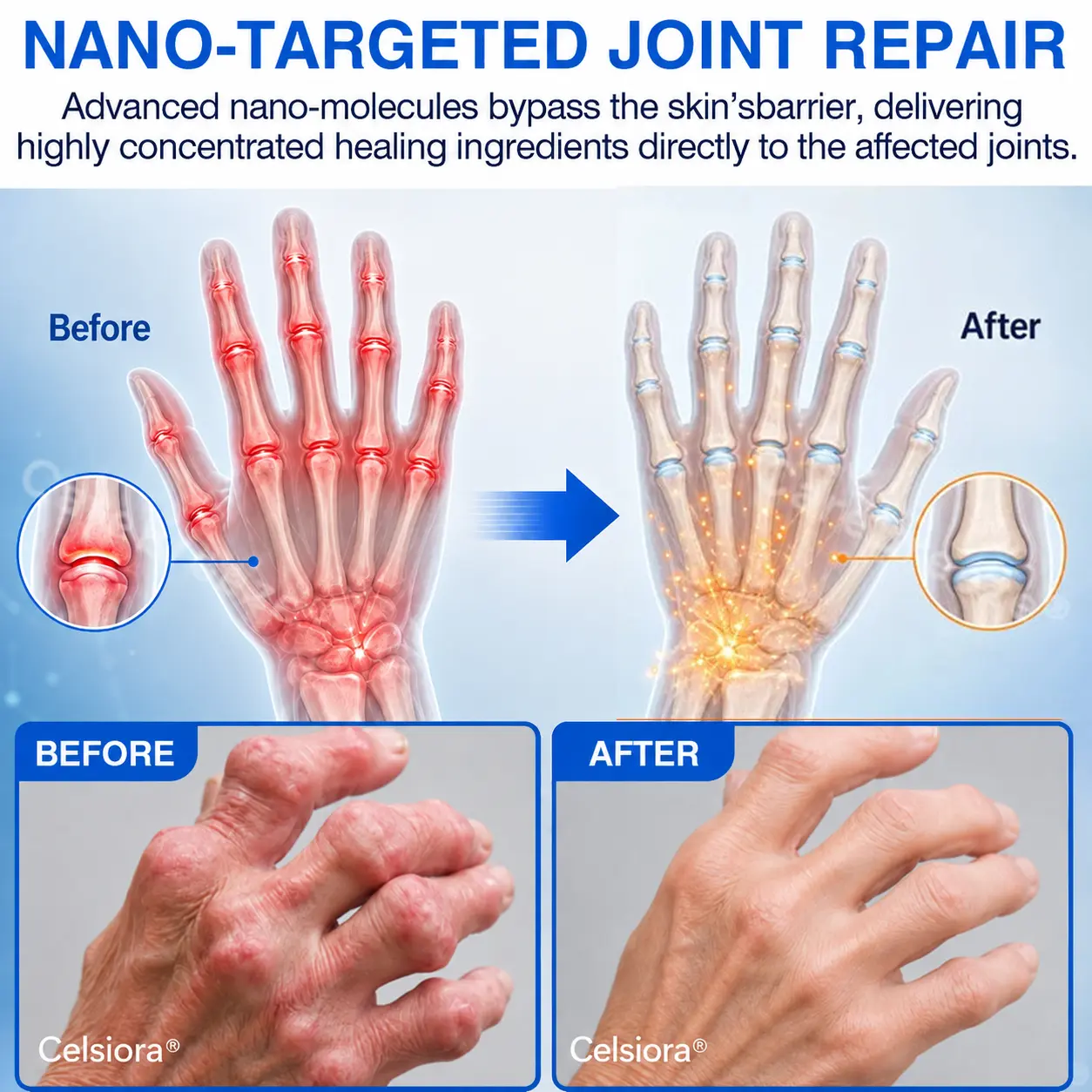 Celsiora® Advanced Microneedle Joint Patch